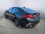 2018 Acura TLX w/Technology Pkg